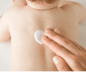 Nappy Rash Cream – Baby Care | كريم طفح الحفاض